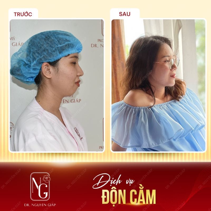 Câu chuyện khách hàng chia sẻ