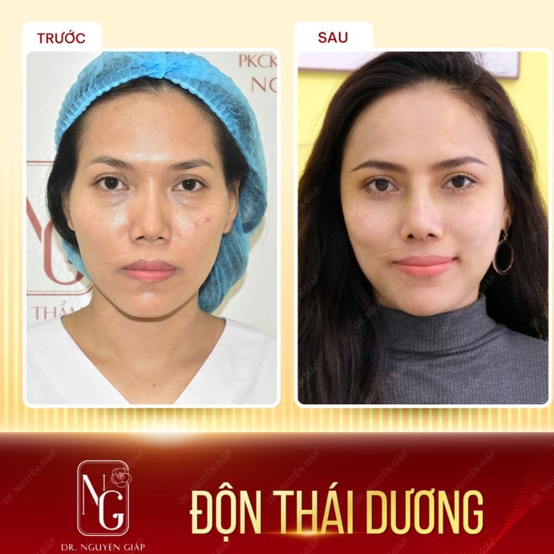 Images customer-made padded temples at the Clinic, Dr Nguyen Giap