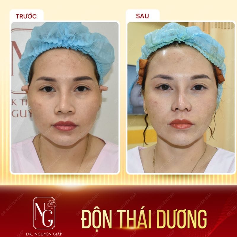 Images customer-made padded temples at the Clinic, Dr Nguyen Giap