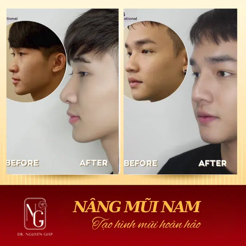 cac dang mui phu hop voi tung loai khuon mat nam gioi