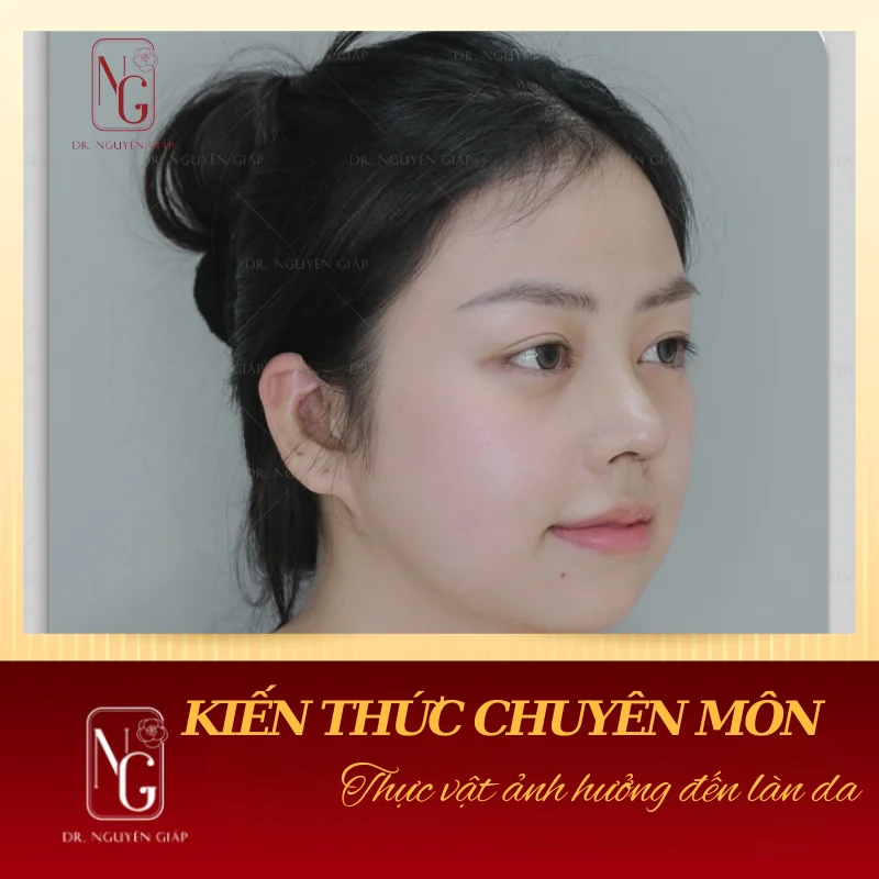 lan da dep cung voi thuc vat