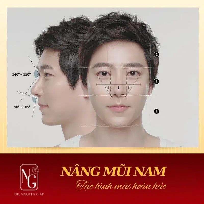 phau thuat nang mui nam gioi o dau dep
