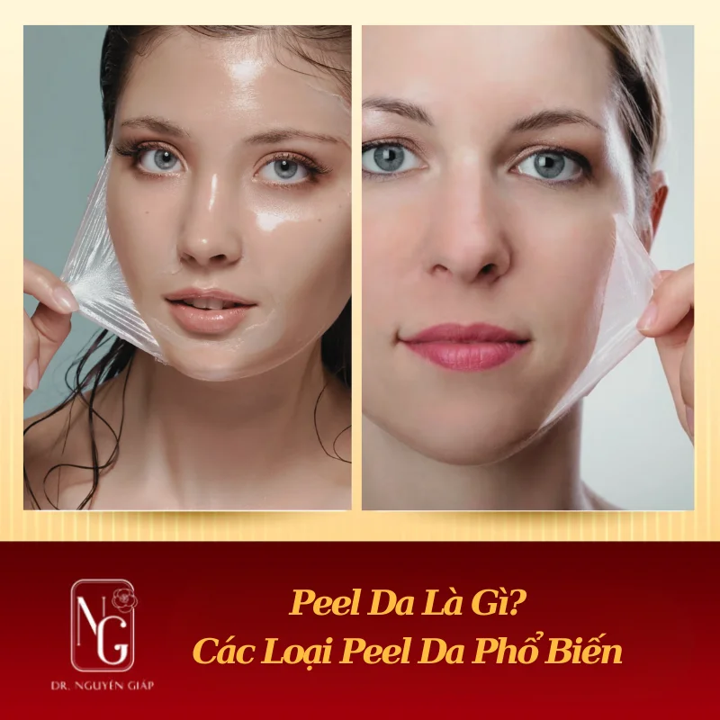Peel Da Là Gì? và các loại phổ biến