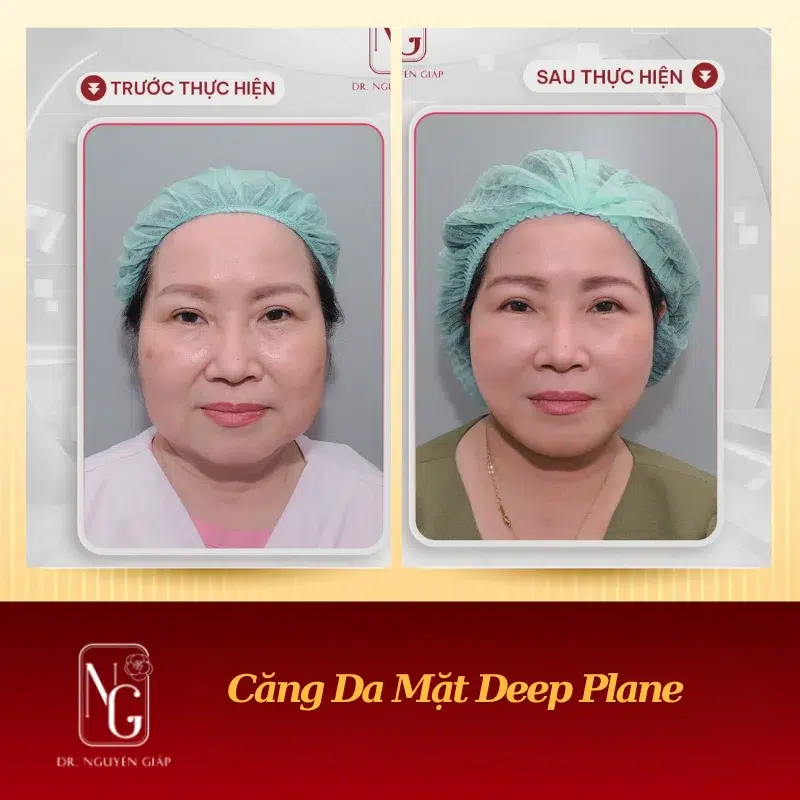 cang da mat deep plane