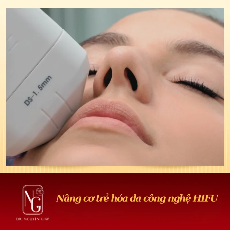 Lift, facial rejuvenation HIFU technology