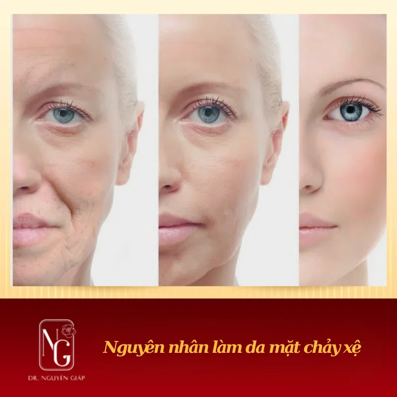 Sagging Facial Skin