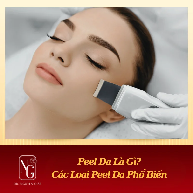 peel da la gi