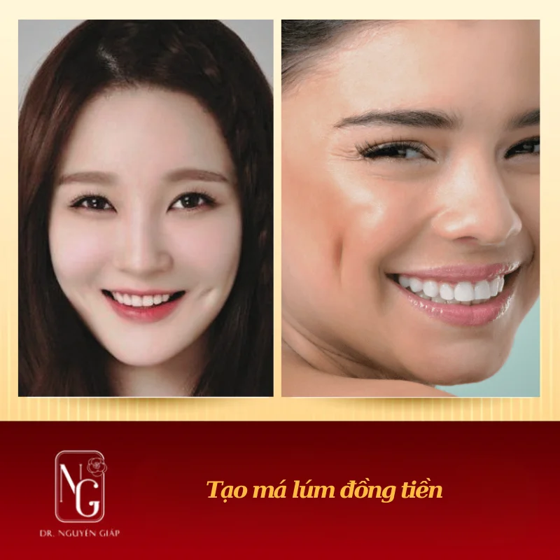 ma lum dong tien cua dien vien noi tieng