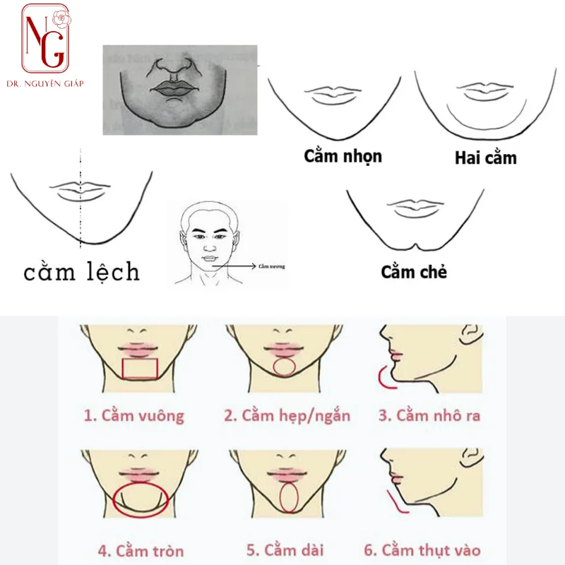 cac loai cam pho bien trong nhan tuong hoc